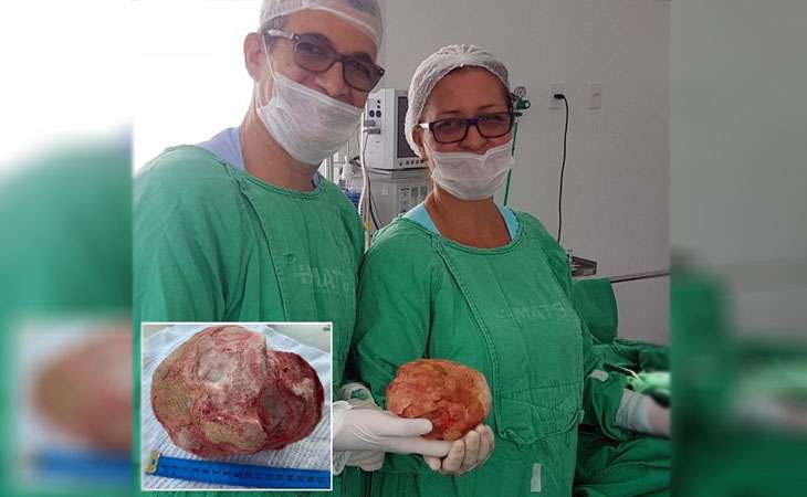 Leia mais sobre o artigo Homem tem pedra de 1,3 quilo retirada da bexiga em cirurgia na Bahia