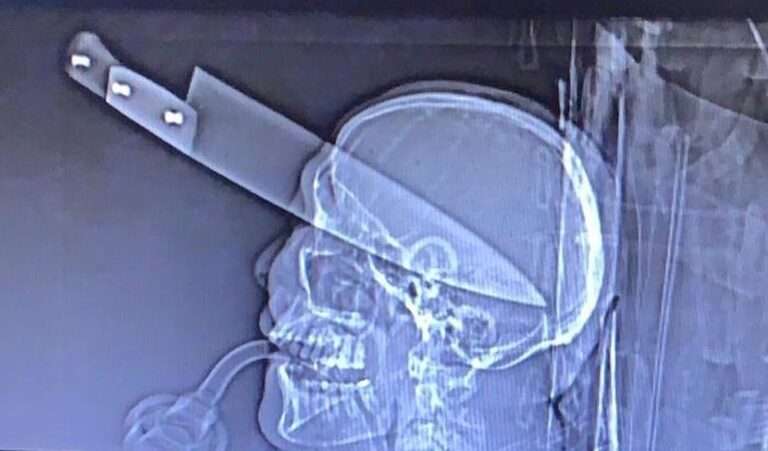 Morre homem atingido com facada no olho em Dourados