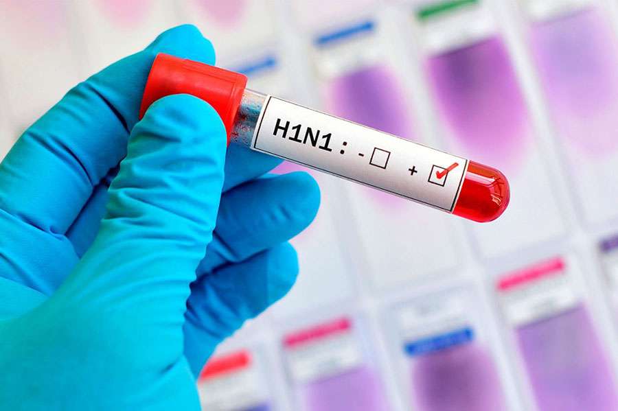 Você está visualizando atualmente Mulher morre com gripe H1N1 em Corumbá