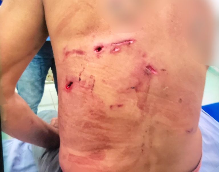 Atacado por onça-pintada em MS é salvo graças a cinco cachorros de estimação