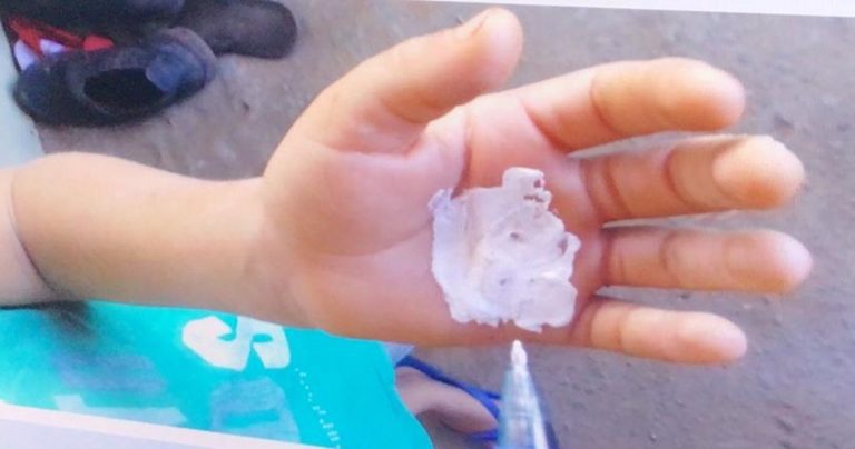 Mulher é presa por queimar mão de criança após dar falta de R$ 10 reais