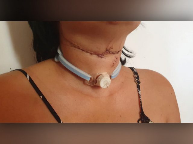 Depois de 11 facadas, mulher de 30 anos comemora a vida em casa