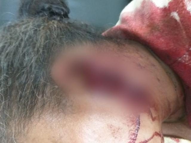 Homem é preso após cortar orelha de mulher com facão em MS