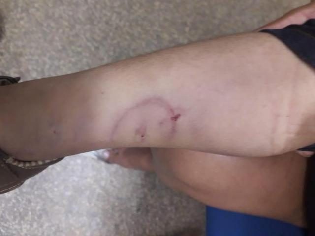 Criança de 3 anos foi torturada pelo padrasto por fazer xixi na cama