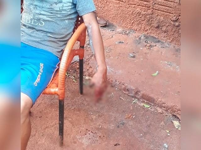 Menino perde os dedos em explosão de granada da polícia após conflito em Dourados