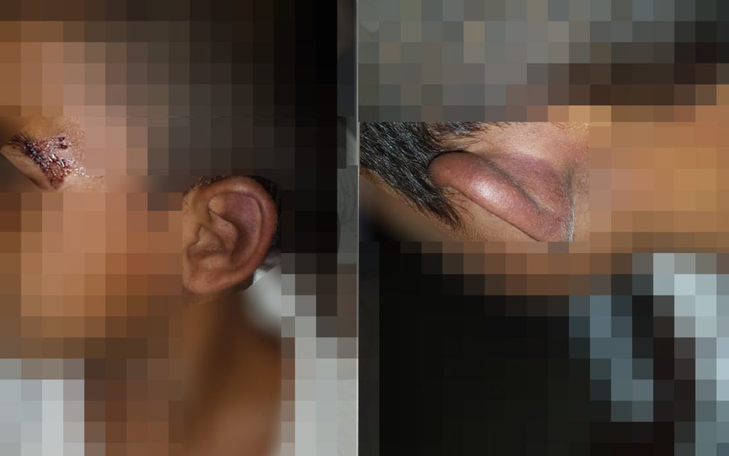 Mulher é presa acusada de torturar criança de 4 anos em Ladário 2 tortura