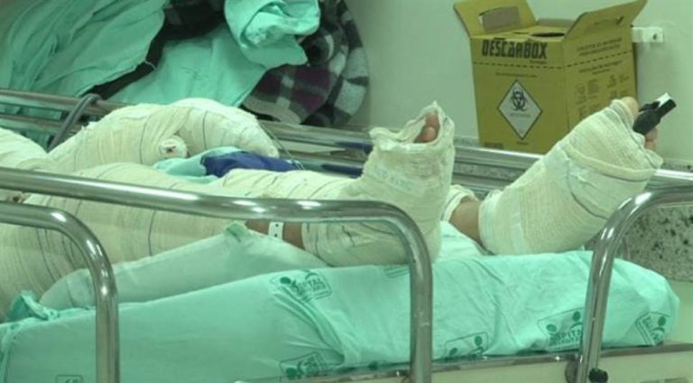 Mulher põe fogo e queima 90% do corpo do marido no interior de MS