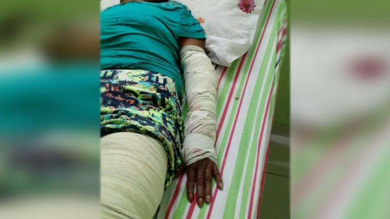 Idosa de 79 anos é atropelada por motorista embriagado no Cristo Redentor