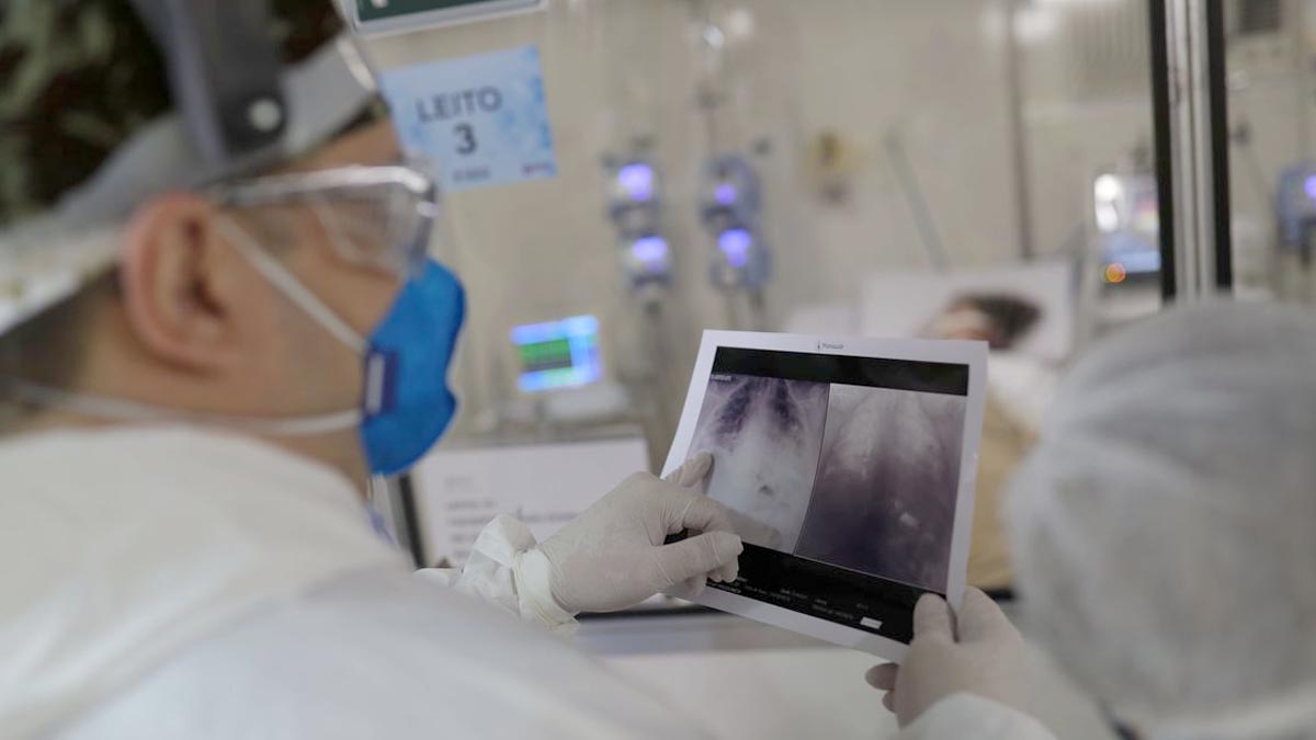 MS confirma 1.259 novos casos de Covid-19 em 24 horas