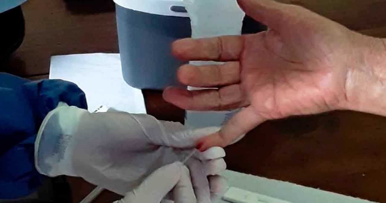 Em Corumbá, profissionais de saúde iniciam testes para Covid-19