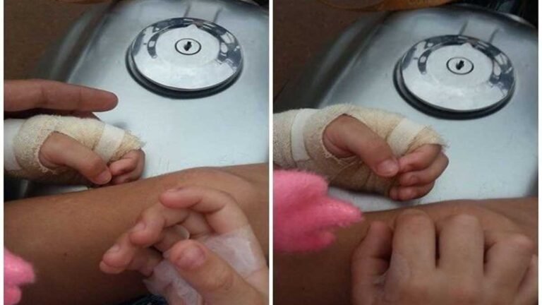 Mulher é acusada de queimar mãos de criança em Dourados