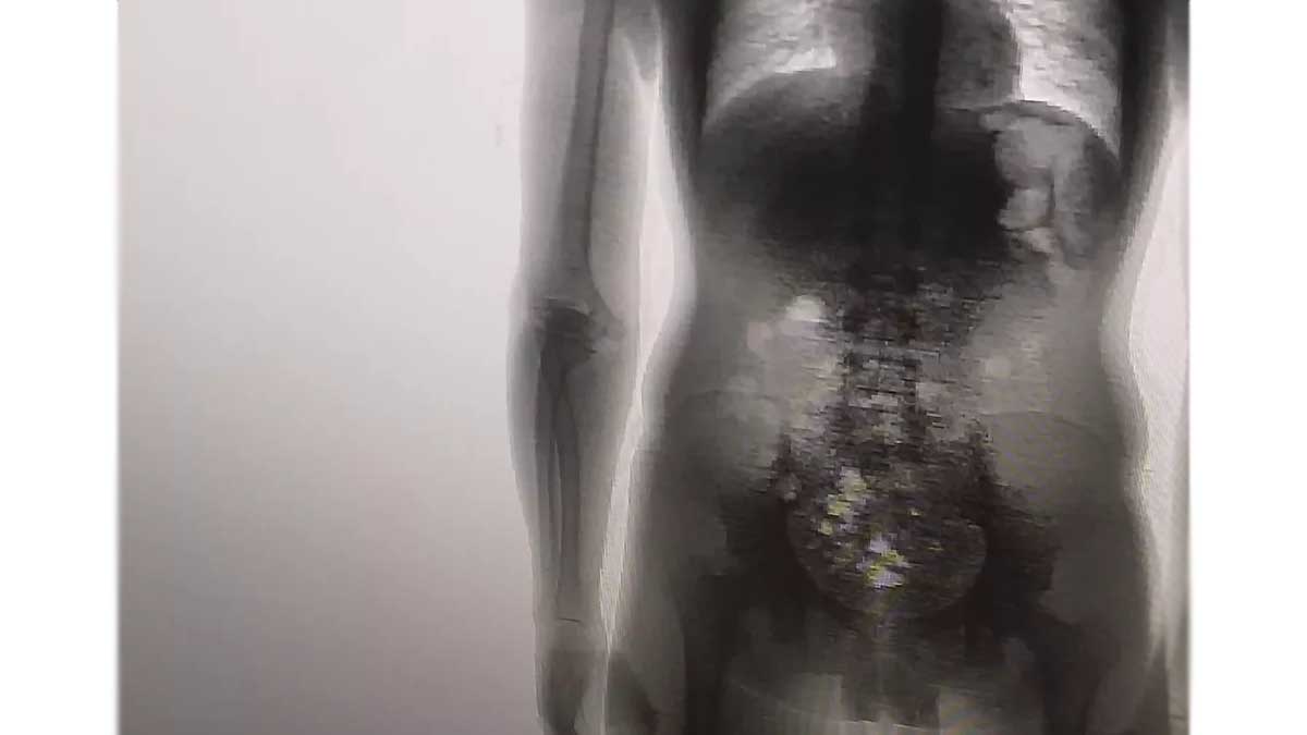 celular em corpo