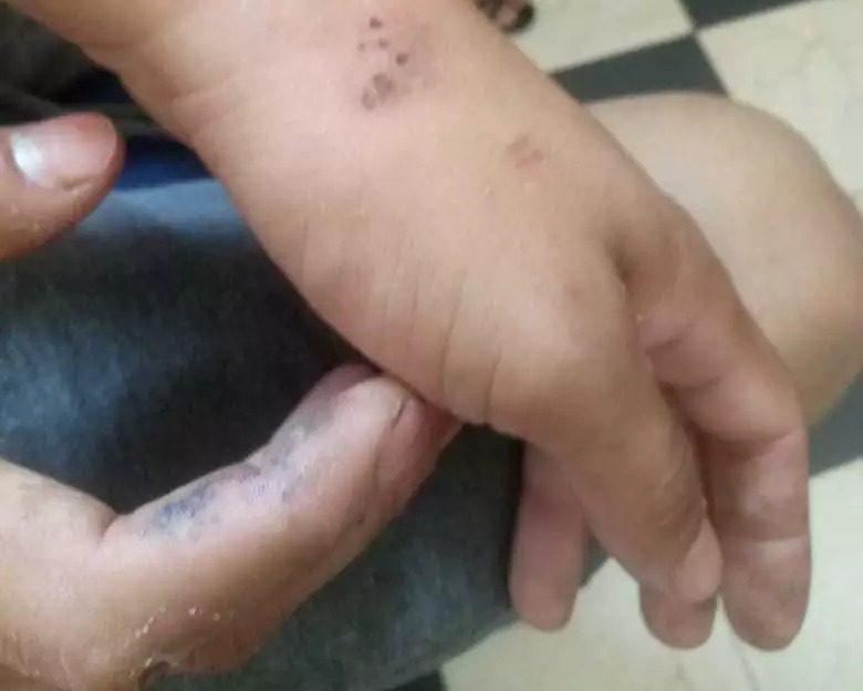 Família acusa enfermeiras de "torturar" jovem esquizofrênico em Corumbá 3 18278d71 9adf 40b6 aebc cf29ab8d40da