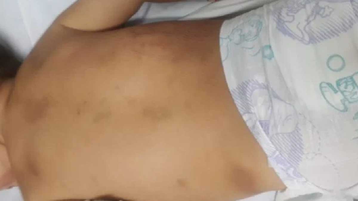 crianca agredida