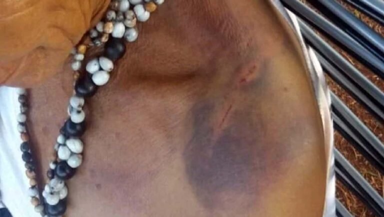 Indígenas denunciam ao MPF casos de tortura após escolha de novo líder em aldeia de MS