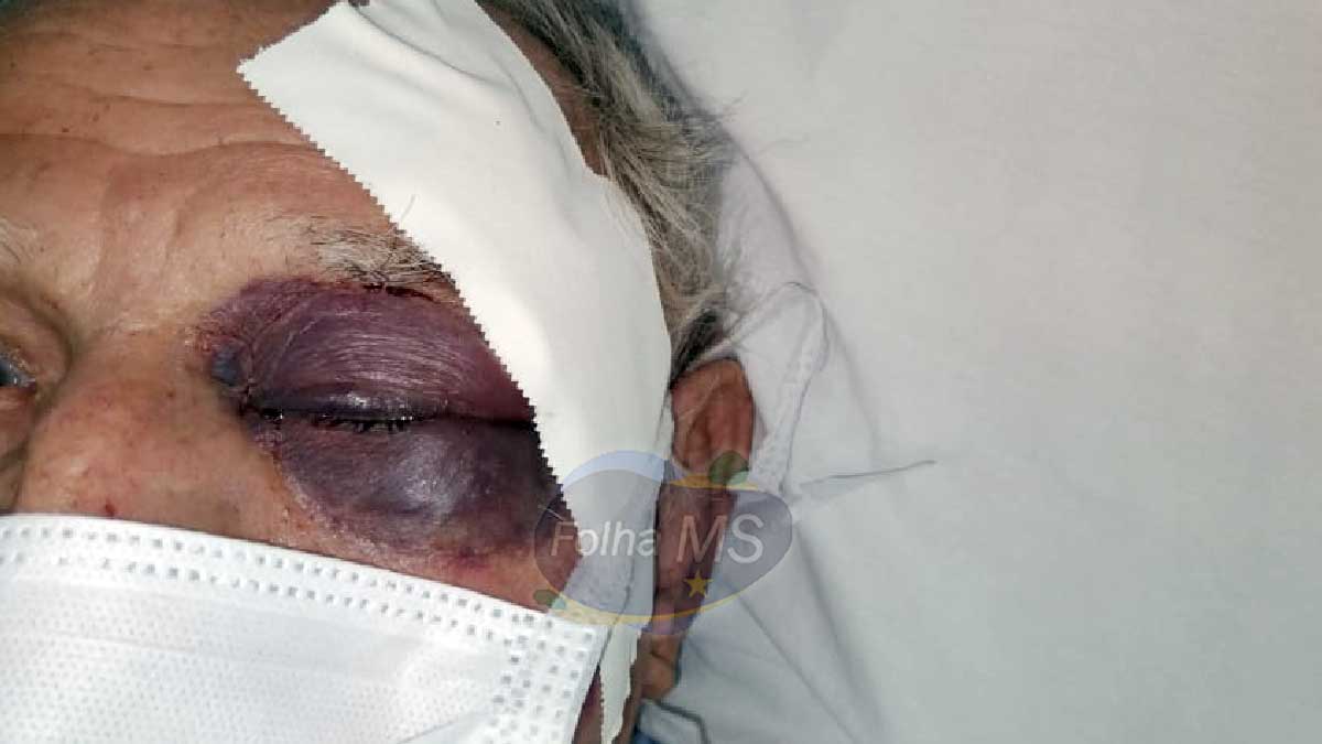 Você está visualizando atualmente Idoso de 92 anos é espancado durante tentativa de assalto no centro de Corumbá