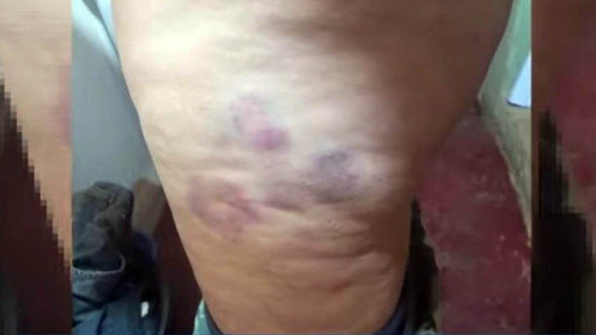 mulher agredida tres lagoas