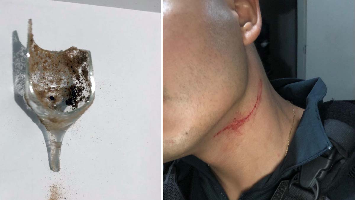 policial ferido