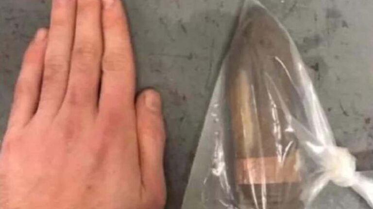 Hospital aciona equipe antibomba para receber homem com bala de canhão no reto