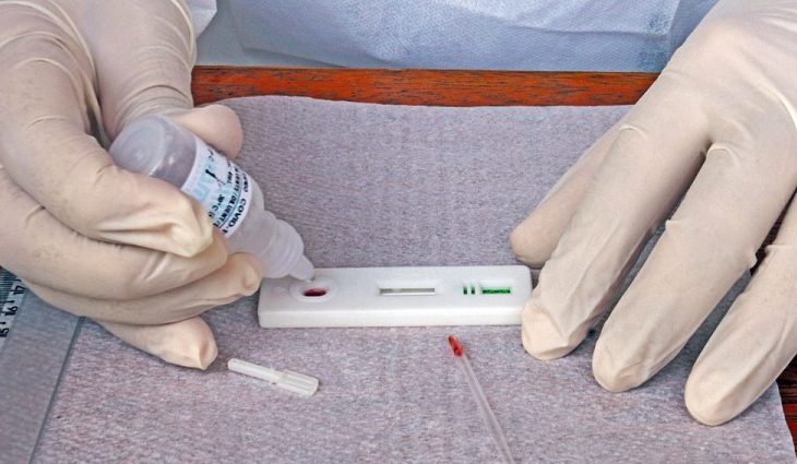 Mato Grosso do Sul registra 409 novos casos de Covid e 15 óbitos