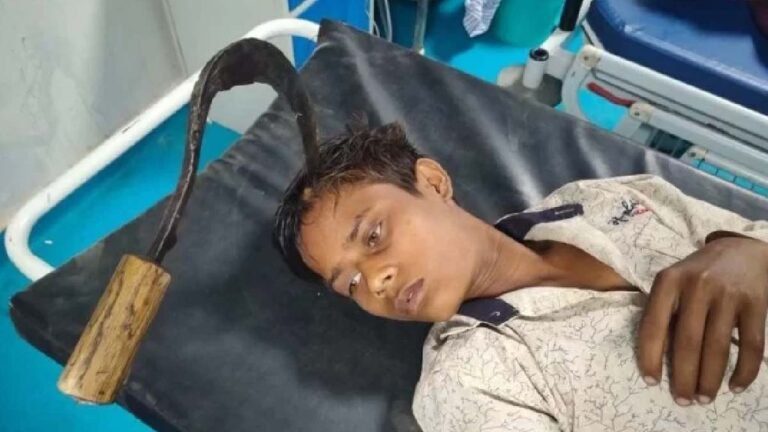 Adolescente fica com foice cravada na cabeça após cair da cama