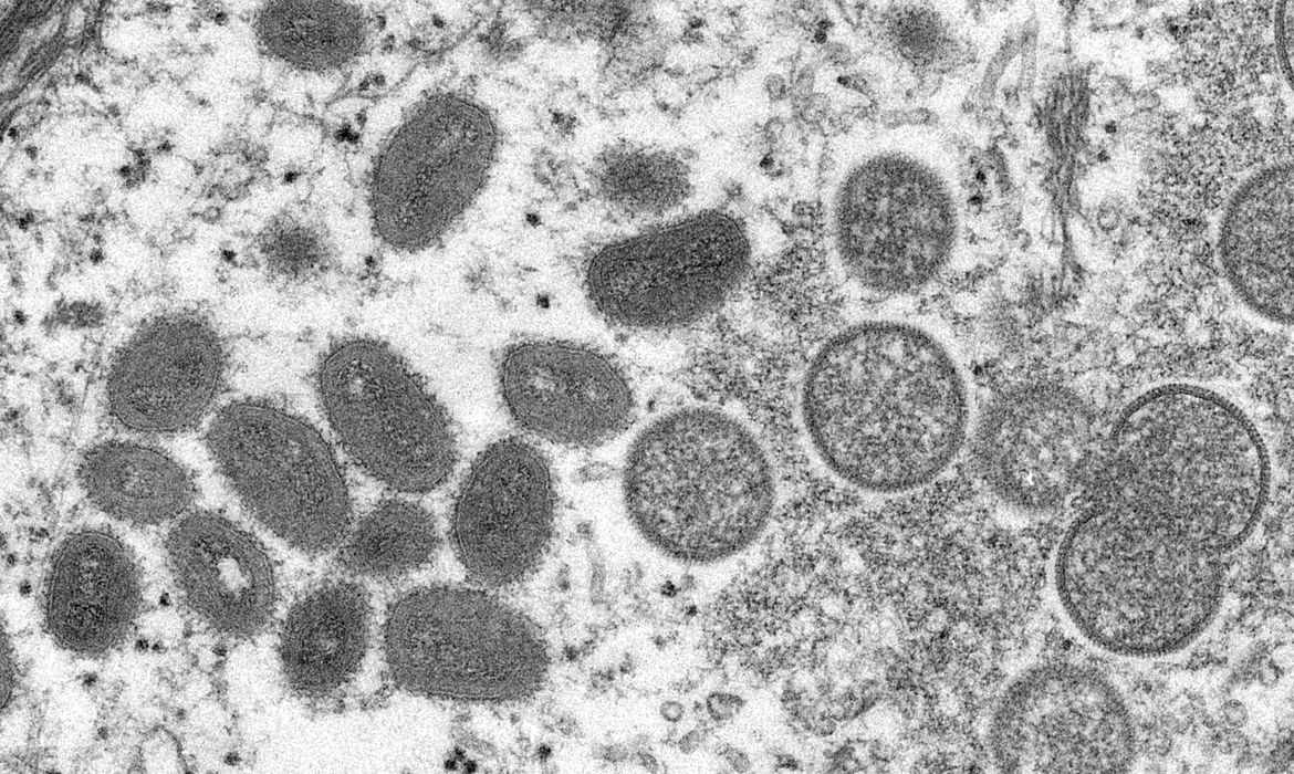 Você está visualizando atualmente Brasil registra terceiro caso de varíola dos macacos