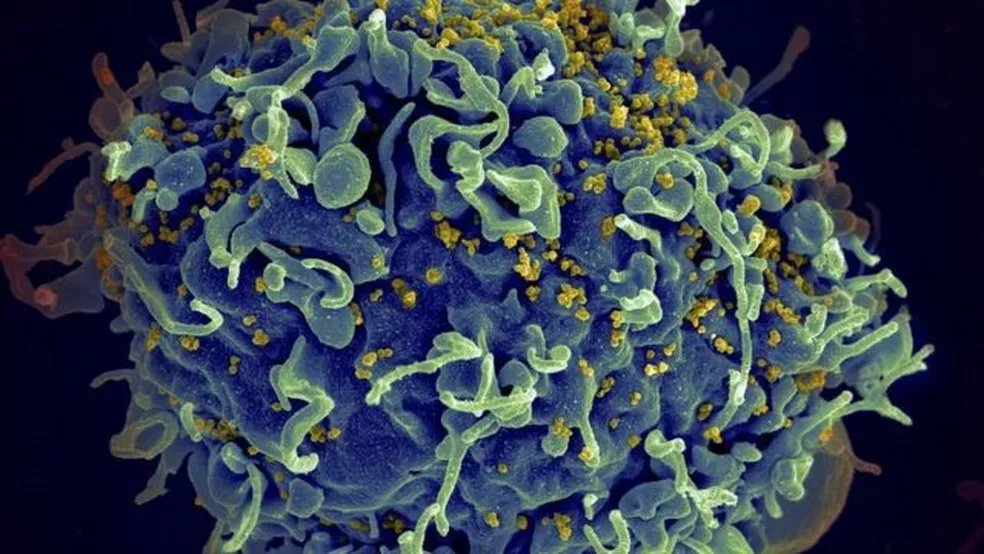 Leia mais sobre o artigo EUA: Médicos anunciam quarto caso de cura do HIV