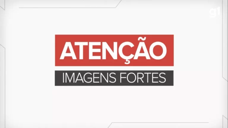 Morre mulher que teve tumor de 46kg retirado em cirurgia de emergência em Itaperuna, no RJ