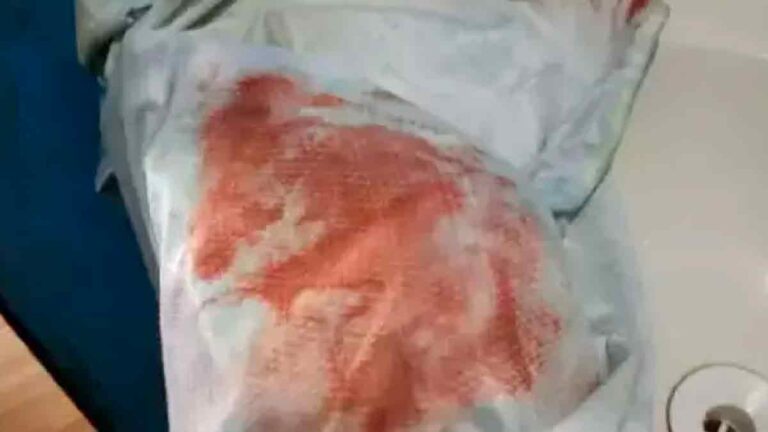 Idosa com problemas psiquiátricos é abusada sexualmente em cidade de MS