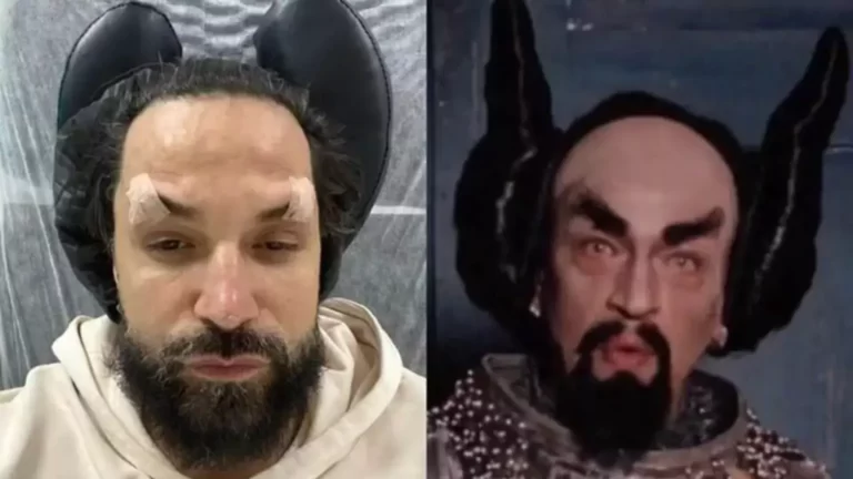Latino vira meme após postar foto de procedimento facial na internet