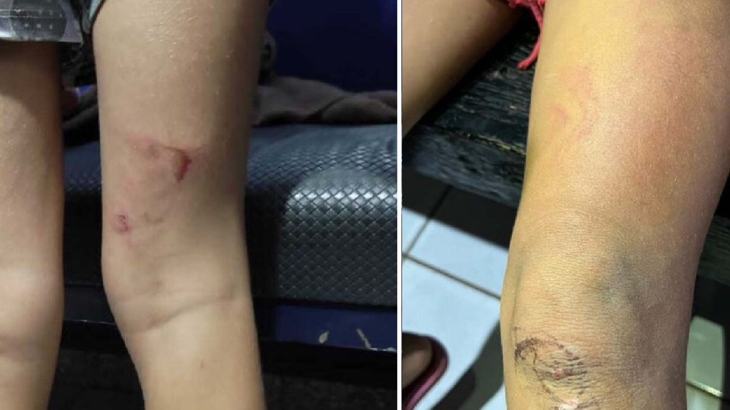 tortura criancas2
