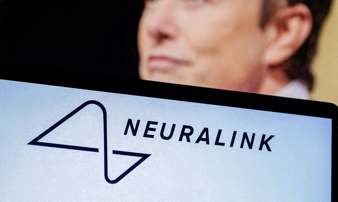 2023 09 19t200421z 1884970184 rc289y9q8ef1 rtrmadp 3 neuralink trial