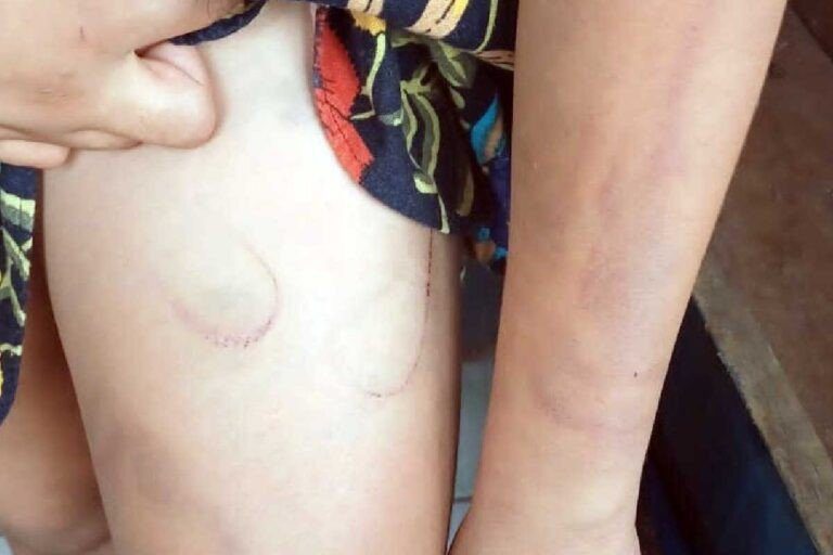 Mulher denuncia ex-companheiro por agressão e maus-tratos à filha autista em Coxim