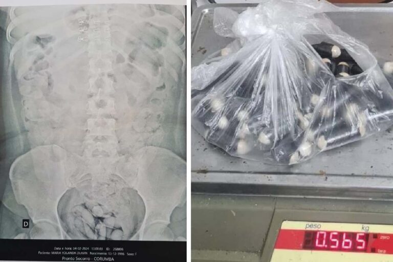 Exército prende homem com 53 capsulas de cocaína no estomago