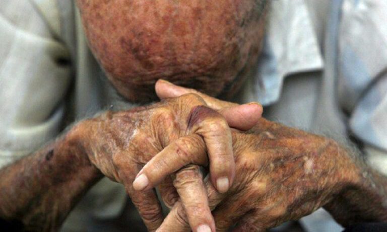 idoso 79 anos