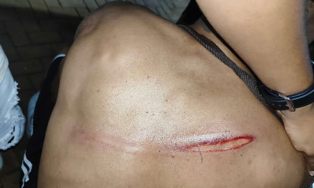 agressao2 agressão