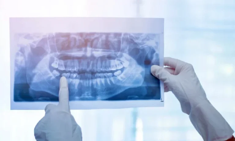 Equipamentos odontológicos como raio-x panorâmico serão adquiridos em MS