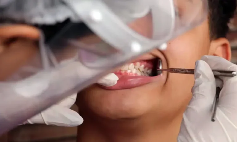 reconstrução dentária