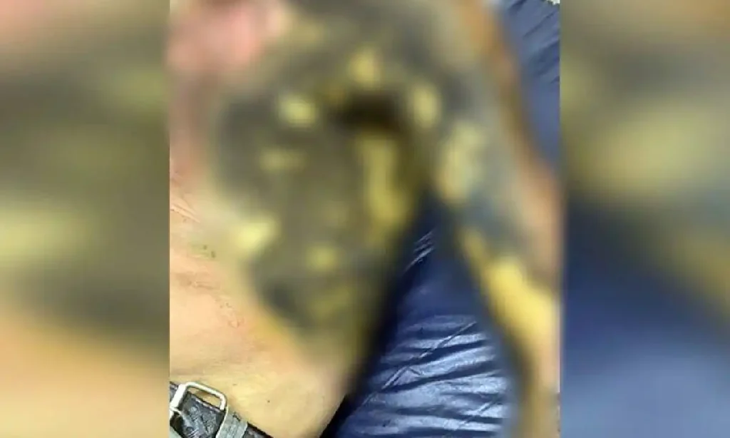 Morador de rua tem corpo incendiado por adolescentes em praça na fronteira 2 Morador de rua teve corpo incendiado na fronteira de MS