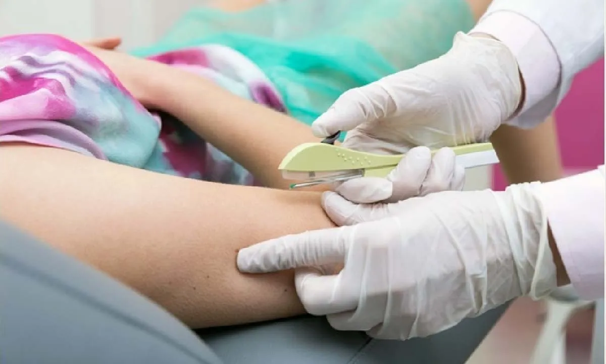 Leia mais sobre o artigo SUS vai oferecer implante contraceptivo que custa até R$ 4 mil gratuitamente