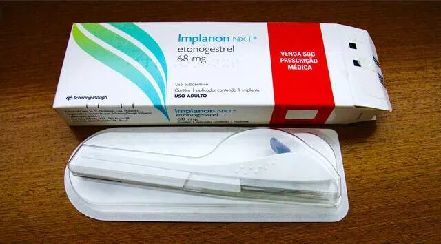 SUS vai oferecer implante contraceptivo que custa até R$ 4 mil gratuitamente 3 inplanon Contraceptivo