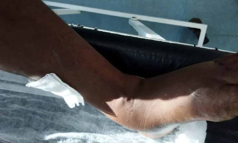 Homem é picado por cobra no Pantanal e resgatado de barco até Corumbá