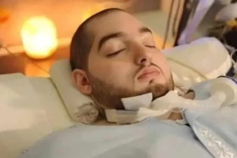 Príncipe adormecido morre após mais de 20 anos em coma