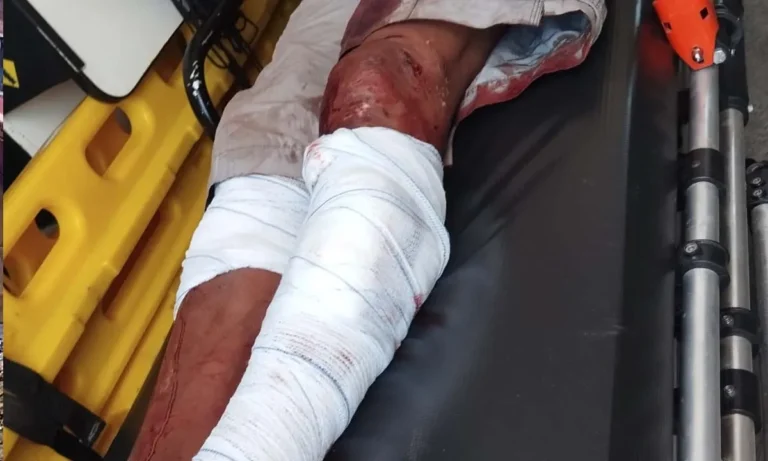 Ataque de cães deixa homem ferido em Corumbá