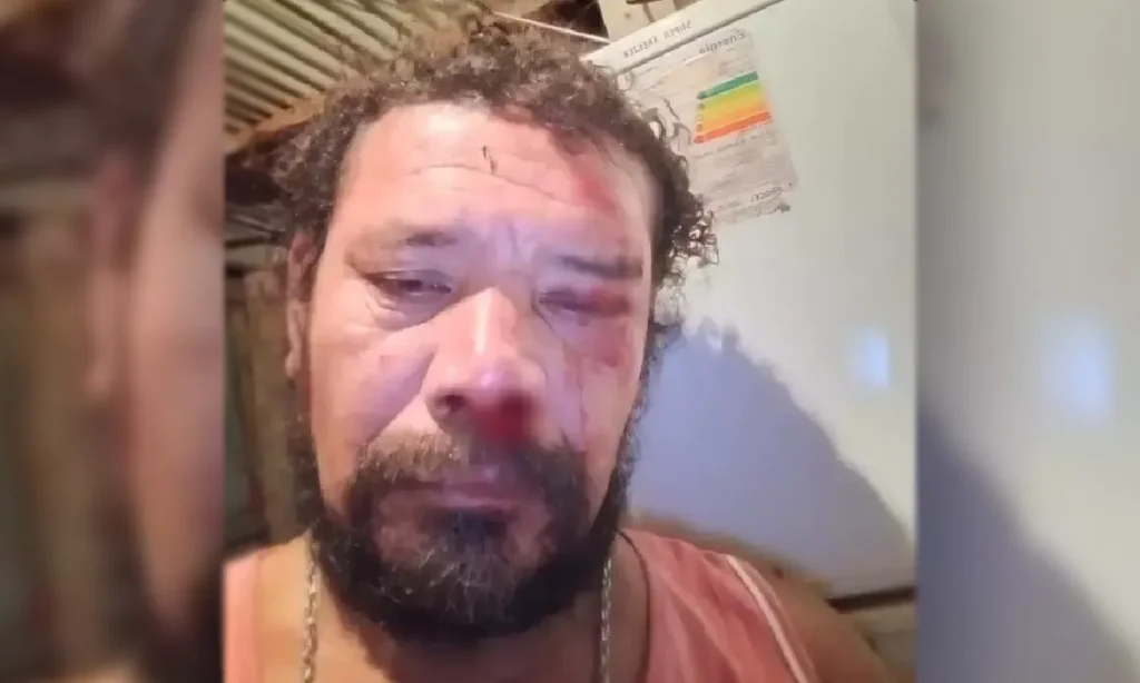 Ibama avalia captura de onça-pintada após ataque a morador em Corumbá 3 Ataque de onça-pintada em Corumbá deixa homem ferido e acende alerta sobre presença do animal