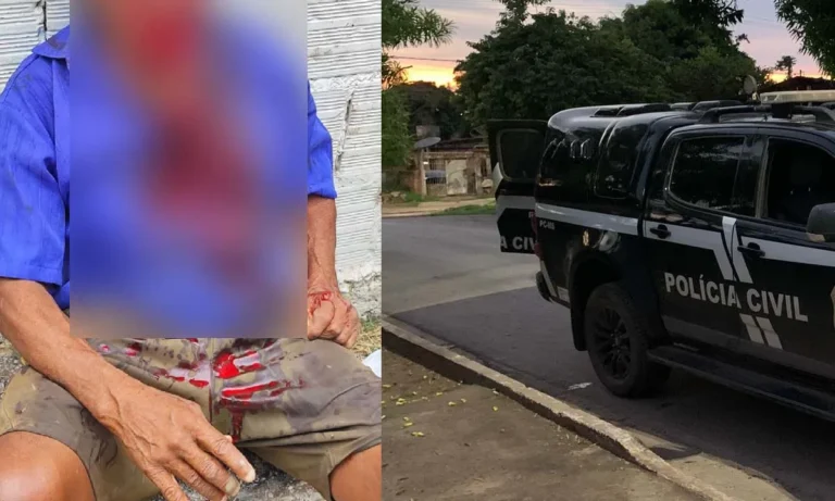 Polícia Civil identifica e indiciados donos de pitbull que atacou idoso no bairro Aeroporto, em Corumbá.