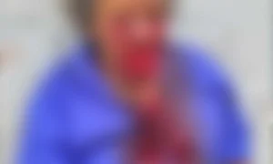 Leia mais sobre o artigo Homem tem rosto dilacerado após ataque de PitBull em Corumbá
