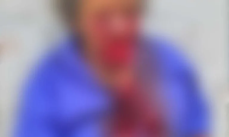 vítima ataque de pitbull