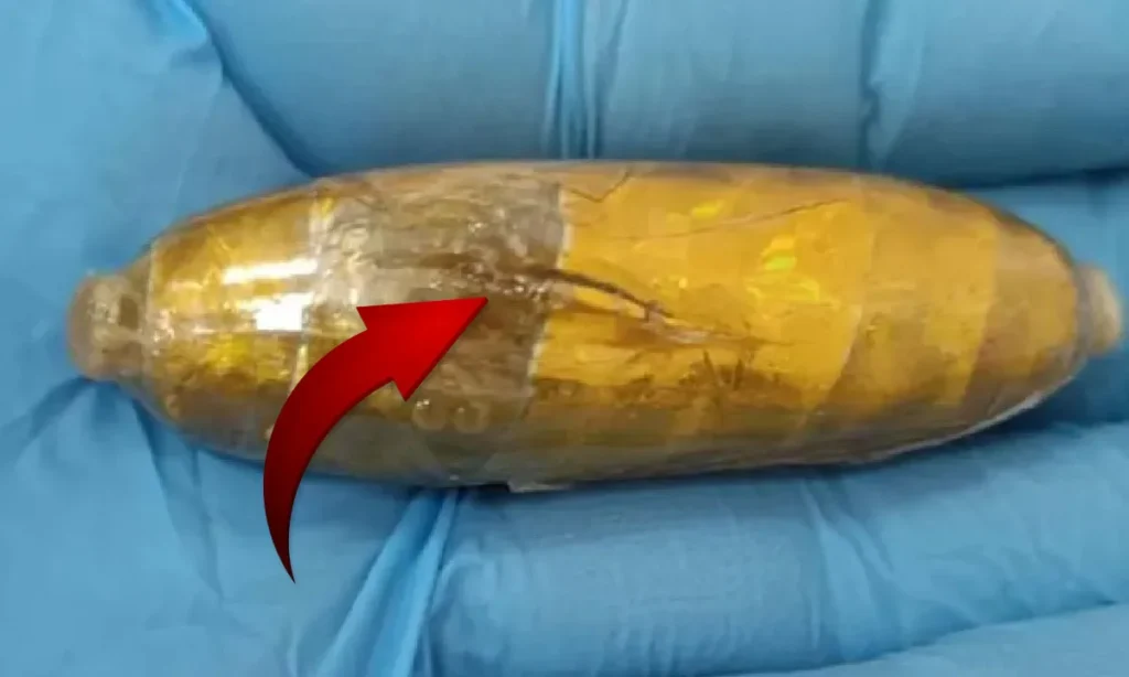 Boliviana morre em viagem de ônibus com 78 cápsulas de cocaína no estômago 1 capsulas de cocaína no corpo de boliviana se romperam