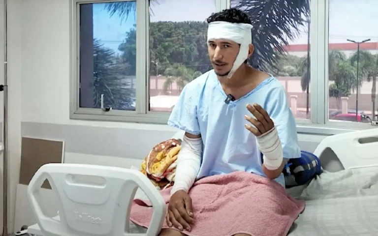 Pantaneiro de 28 anos sobrevive a ataque de onça-pintada na Fazenda Milagres, no Pantanal, e relata momentos de terror. Ele segue internado na Santa Casa de Campo Grande.